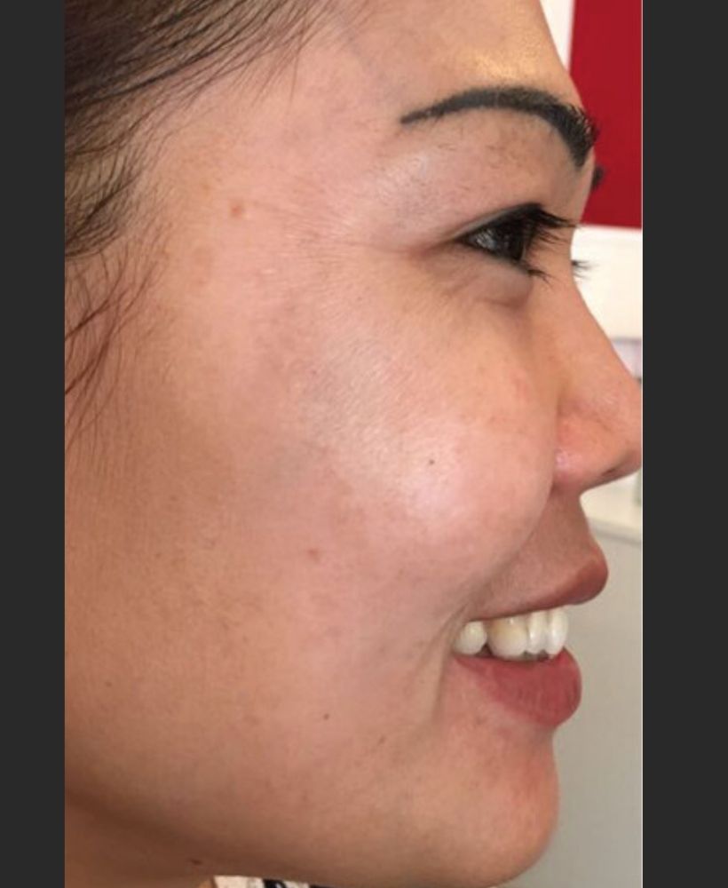 CSD CLINICS | Pigmentation