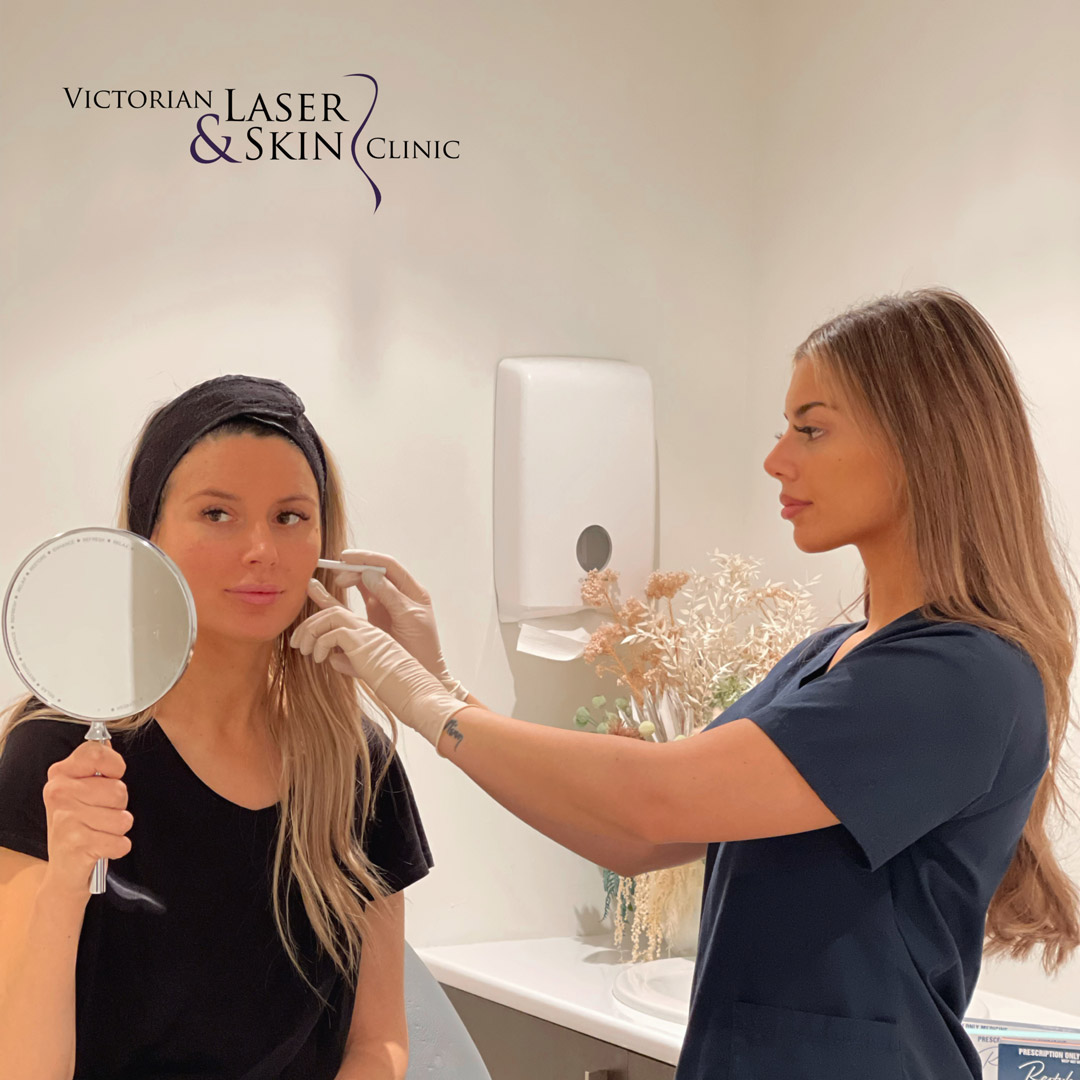 CSD CLINICS | Dermal Filler