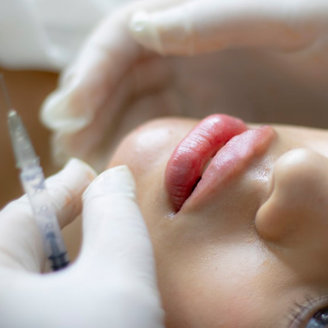 CSD CLINICS | Dermal Filler