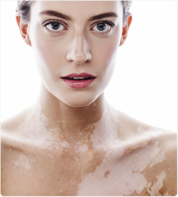 CSD CLINICS | Pigmentation