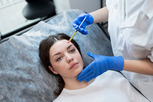 Dermal filler treatment