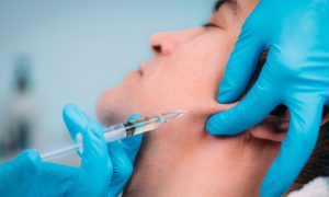 Jawline Filler